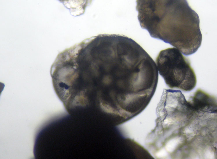 Microfossili o microconchiglie?